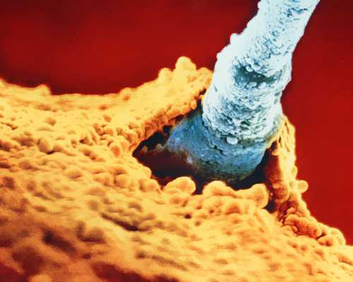 济南代怀价格费用,为什么泰国试管技术也不能避免生化妊娠出现?-济南市济阳区