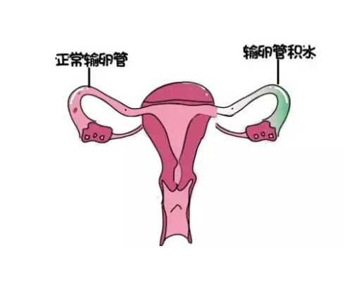 51岁卵巢早衰怎么治疗&试管供卵机构,备孕夫妻不得不知的孕前准备工作