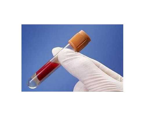 济南哪里借卵靠谱,去济南哪里做试管婴儿？来看一下医院排行榜-彩超怎么能看