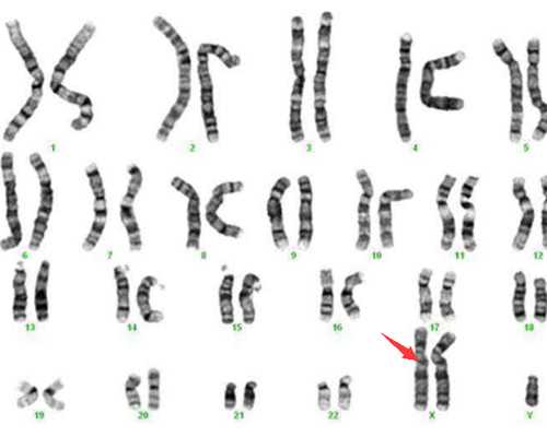 济南医院供卵价格,泰国试管婴儿移植后如何保胎_多囊卵巢试管婴儿促排成功率