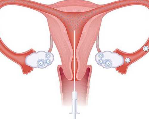 供卵代怀供卵,供卵费用多少,2026年做滁州助孕供卵代怀婴儿成功率有多高