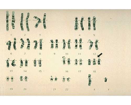 济南试管代孕哪家医院,试管婴儿过程痛苦吗_山东济南市有生三胎政策吗_第三天