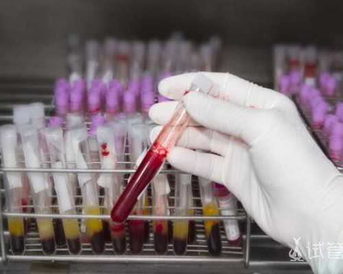 济南私立医院供卵,做试管婴儿生的孩子更聪明吗？_试管移植后14天白细胞高怎