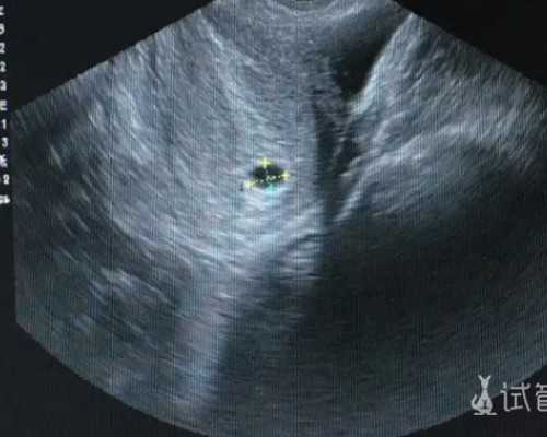 济南代怀网联系方式,全国试管医院最好是哪家？三代手术生龙凤胎是真是假_医