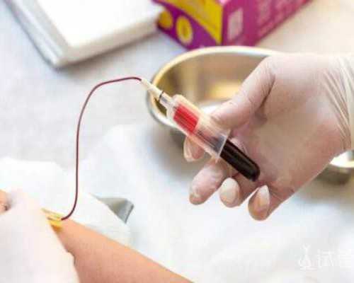 代孕价格表咨询电话&格鲁吉亚试管性别会, 盘点夫妻生活太频繁5大危害，备孕