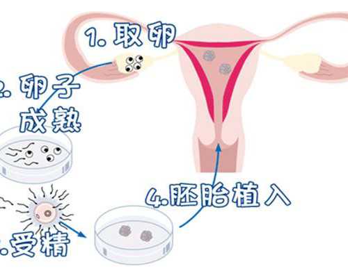 济南代怀一键咨询,西囡医院试管婴儿价格贵不贵？附成都西囡试管情况-上海供