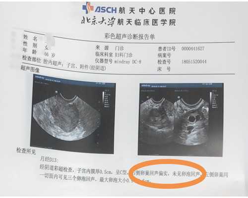 29岁做试管成功率高不&供卵试管婴儿中介,备孕夫妻应该怎样做才能够优生优育
