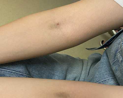 济南高龄借卵价格,赴美试管获国人青睐之缘由-科学安全的促排周期_上海供卵试