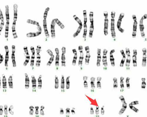 济南正规代生,美国做试管婴儿成功概率是多少？美国在试管婴儿费用是多少？