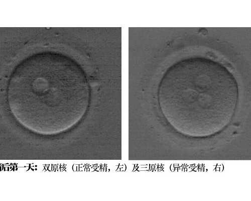 45岁试管促排成功经验&供卵试管产业链,广州不孕不育医院前三，试管成功率高