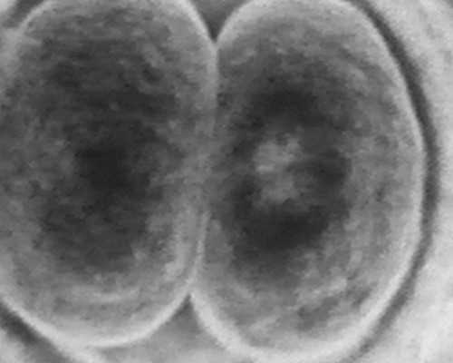 排卵障碍三代会遗传吗